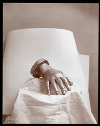 Bronzeguss der rechten Hand von Arthur Rubinstein, 1906